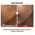 تونر درخشان کننده پیل شات برنج سفید دکتر ملاکسین _روشن کننده و شفاف کننده Dr.Melaxin Peel Shot Glow White Rice Toner - Image 3